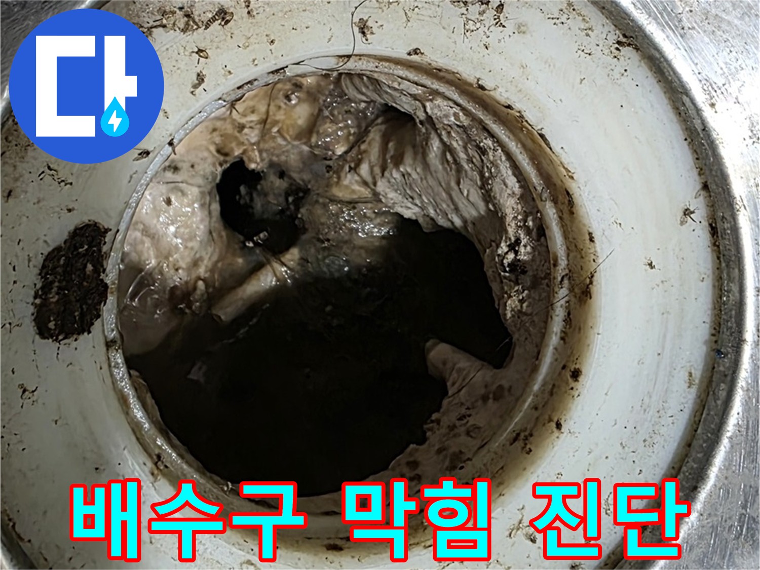 내시경으로 확인한 심각한 욕실 배관 막힘 - 석션 및 스케일링으로 문제 해결