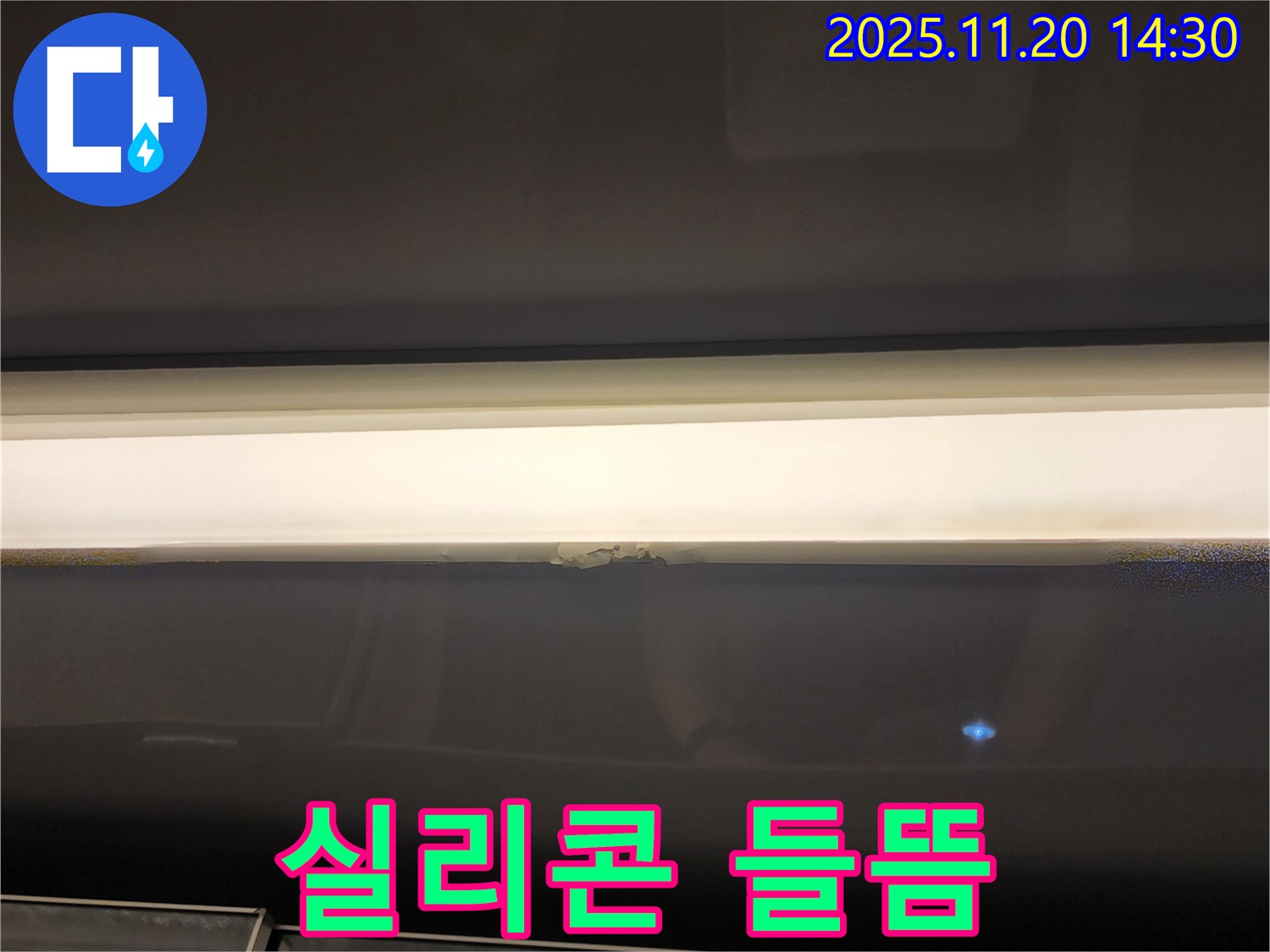 실리콘 들뜸 - 긴급 진단 필요