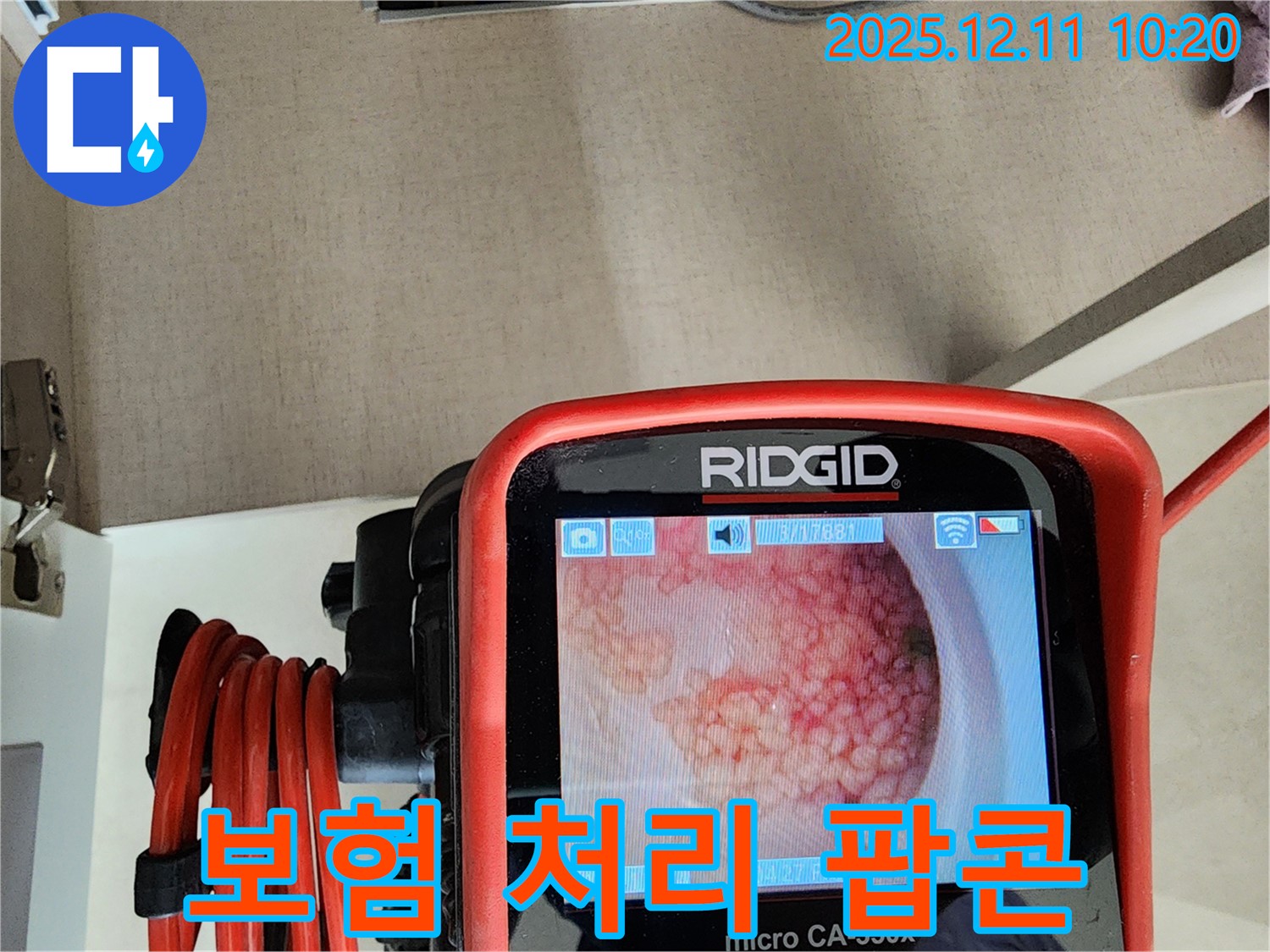 보험 처리 팝콘 - 복잡한 절차